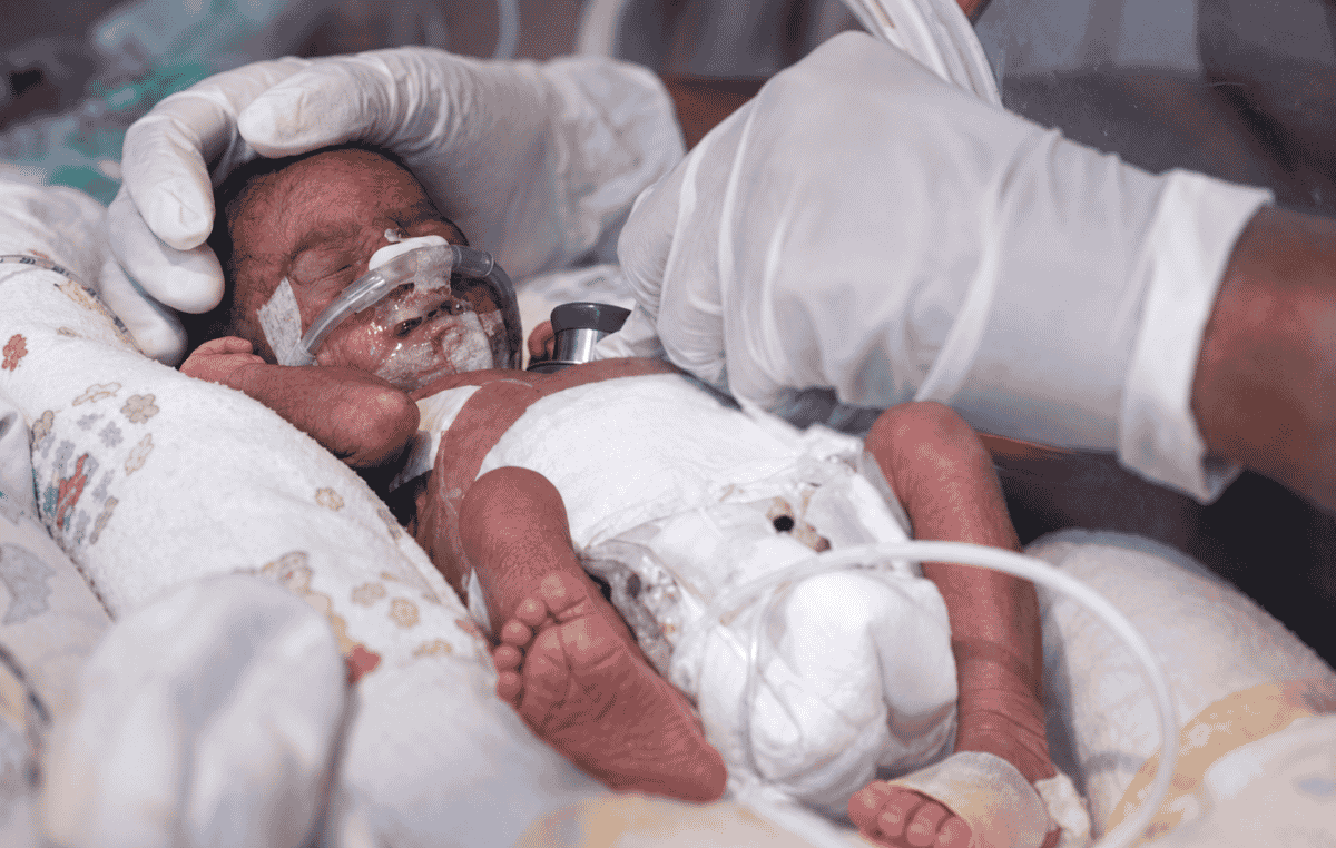 nicu2023infant 300